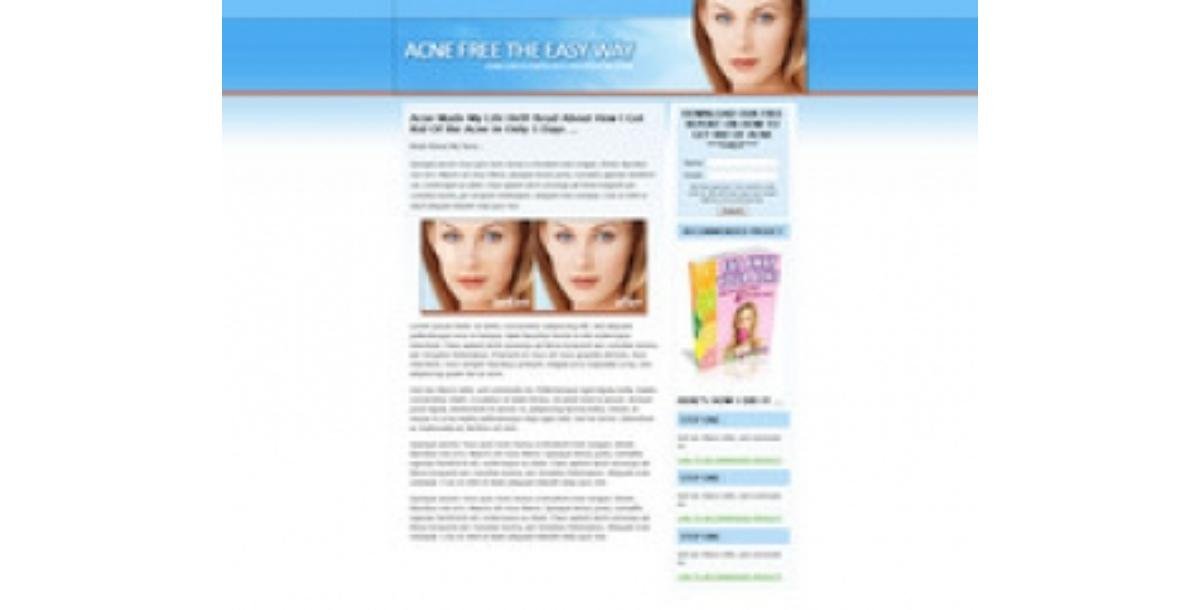 Acne Landing Page Template-3872
