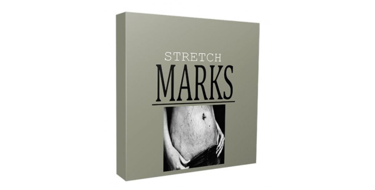 Stretch Marks Niche Website Bundle-4457